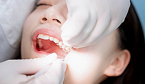 dental filling cost in jb